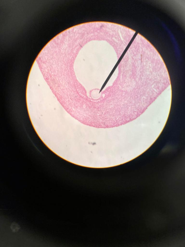 Solved This is histology of Ovary. Determine the right name | Chegg.com