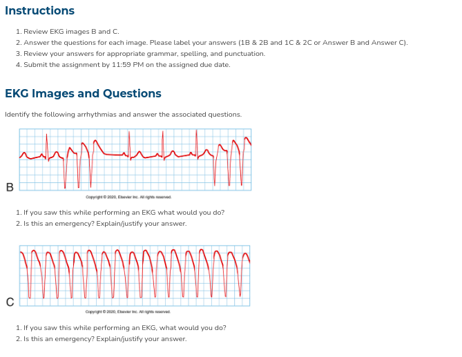 Solved Instructions 1. Review EKG Images B And C. 2. Answer | Chegg.com