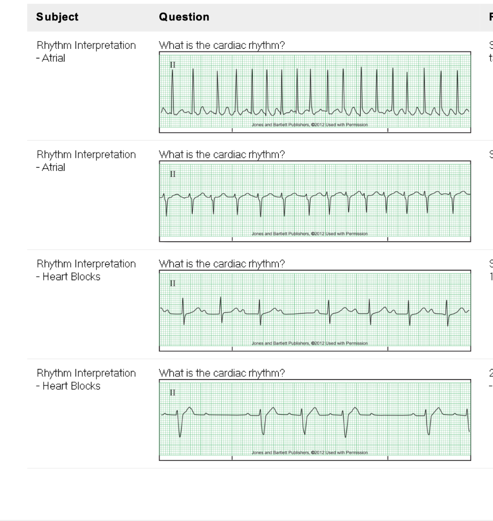 Subject Question F What is the cardiac rhythm? Rhythm | Chegg.com