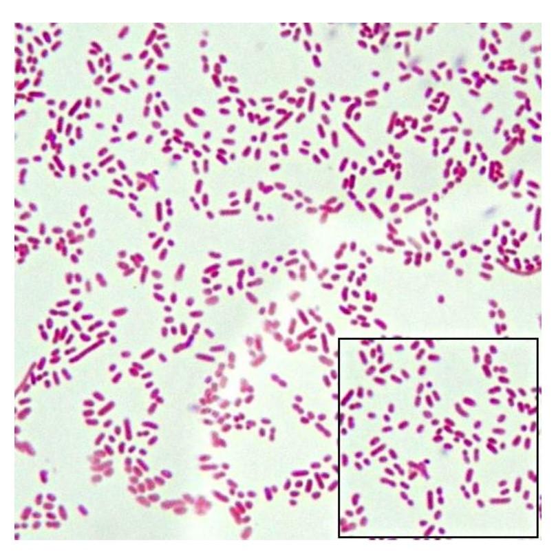 staph bacteria gram stain