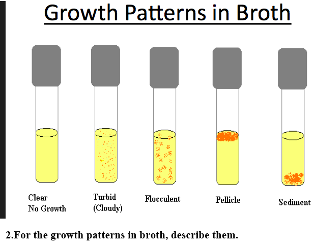 Solved Growth Patterns in Broth o Clear No Growth Turbid | Chegg.com