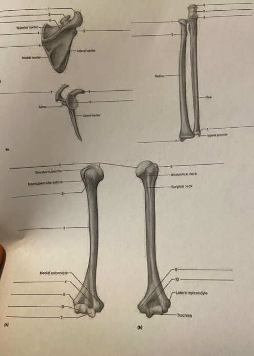 Solved Melborder Greater tubercle Anatomical neck | Chegg.com