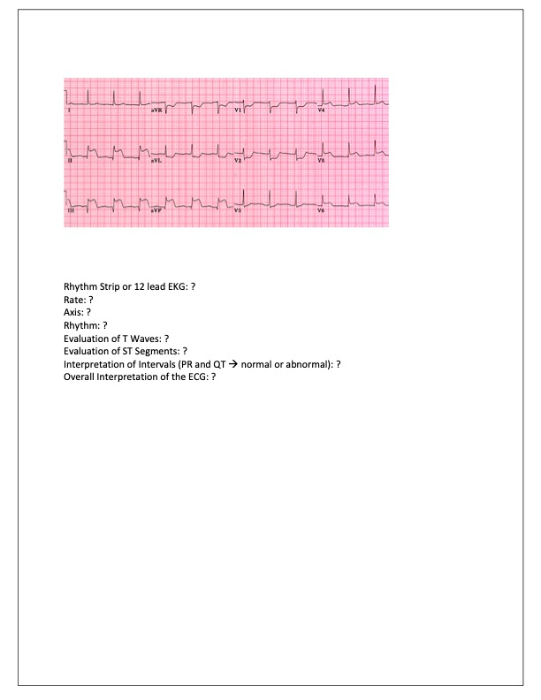 Solved Rhythm Strip Or 12 ﻿lead EKG: ?Rate: ?Axis: ?Rhythm: | Chegg.com