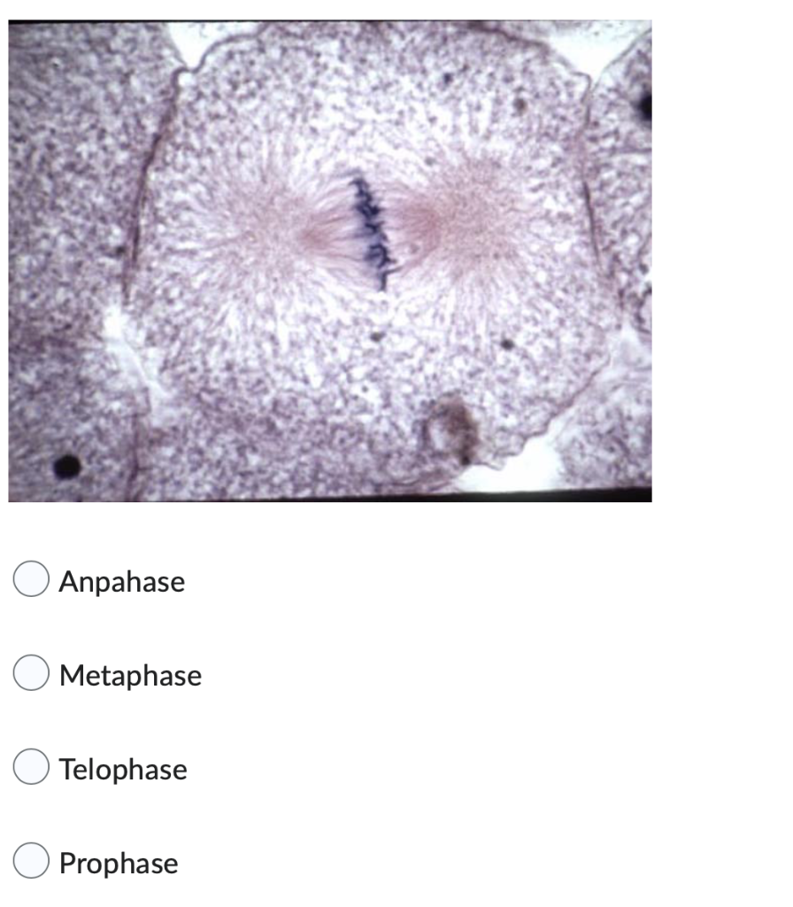 Solved Anpahase Metaphase Telophase Prophase | Chegg.com