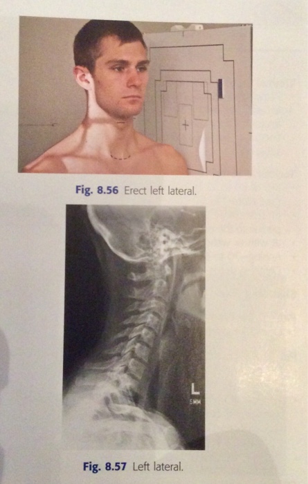 Chapter 8 C Spine T Spine Flashcards Chegg Com