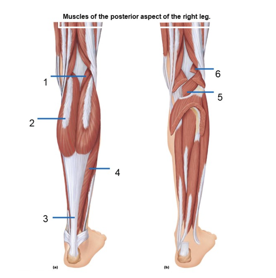 Solved ID all the highlighted muscles Part 1 Section | Chegg.com