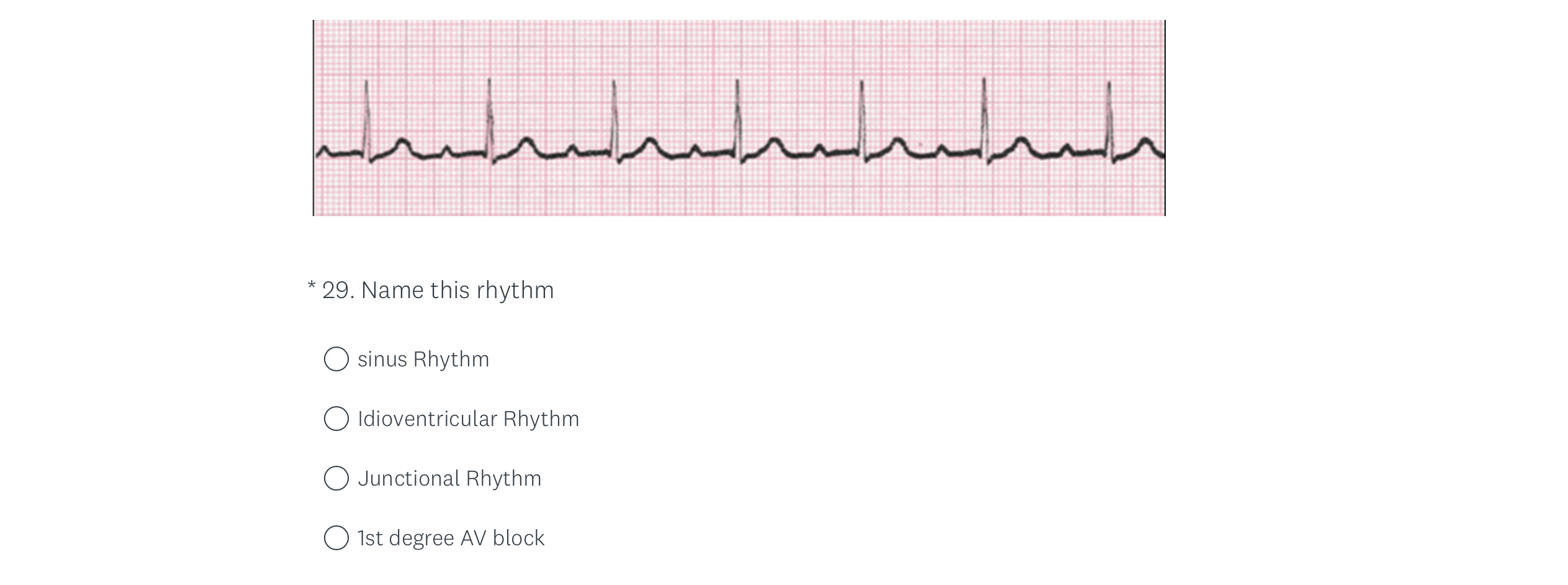 Solved Atrial fibrillation Sinus Rhythm with PJC Sinus | Chegg.com