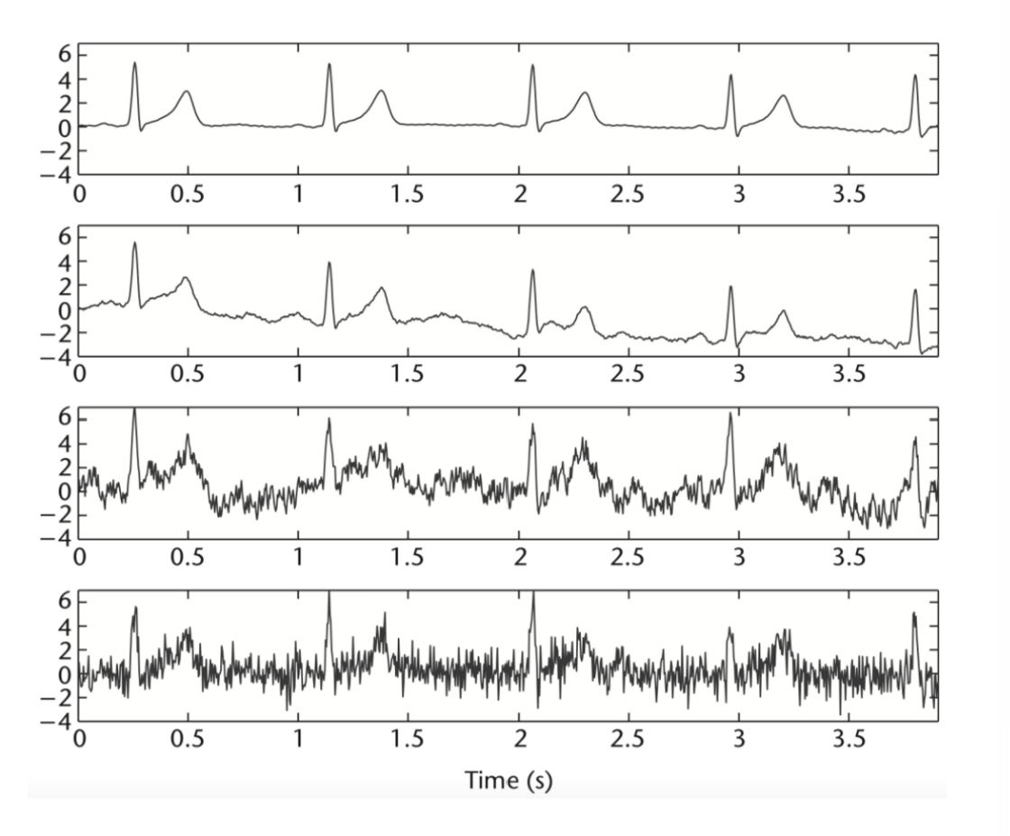 this is the ecg signal obatined in my assignment 2 | Chegg.com