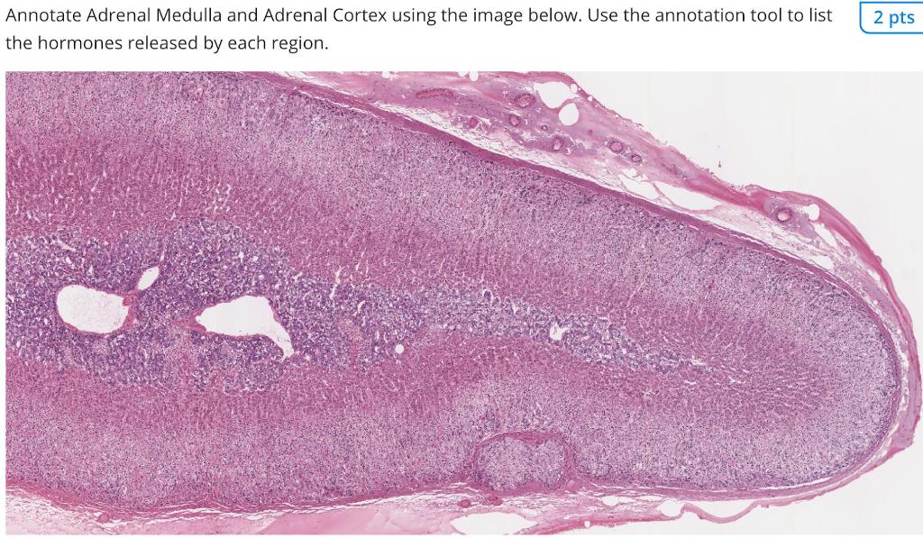 Solved Annonate Adrenal Medulla and Adrenal Cortex using the Biology Diagrams