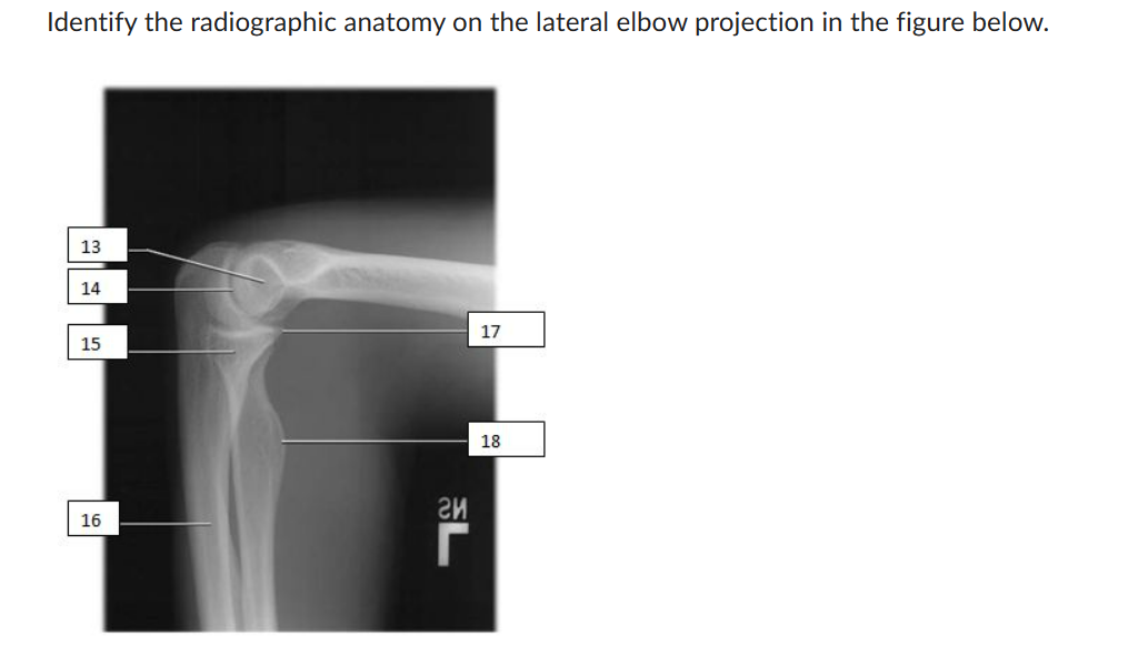 Identify the radiographic anatomy on the lateral