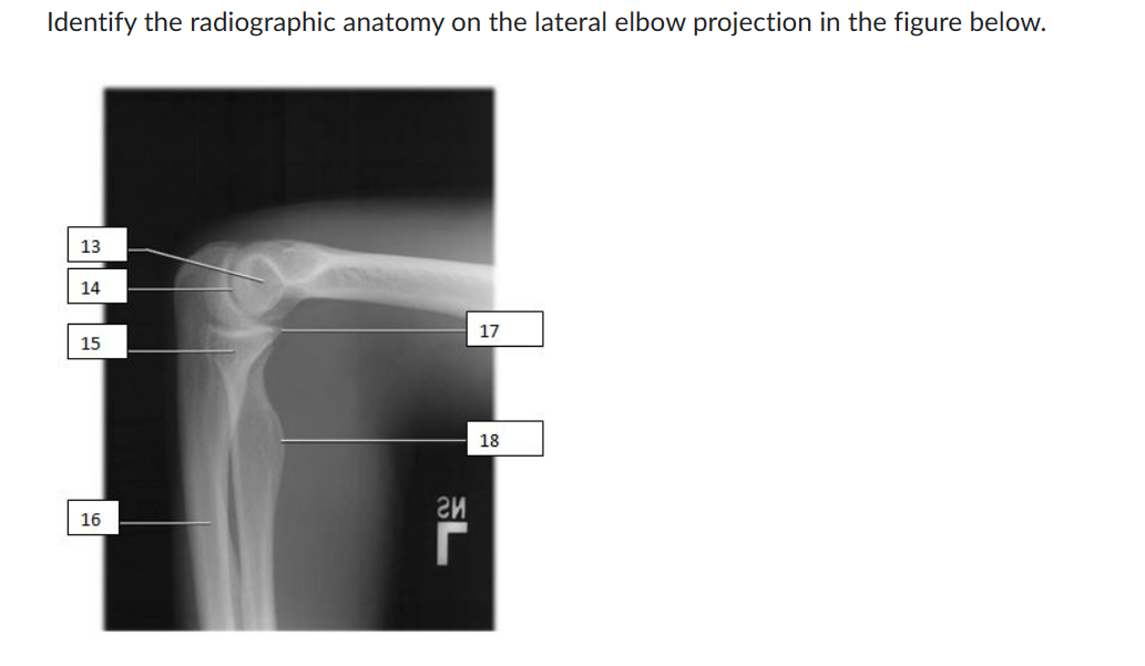 Identify The Radiographic Anatomy On The Lateral