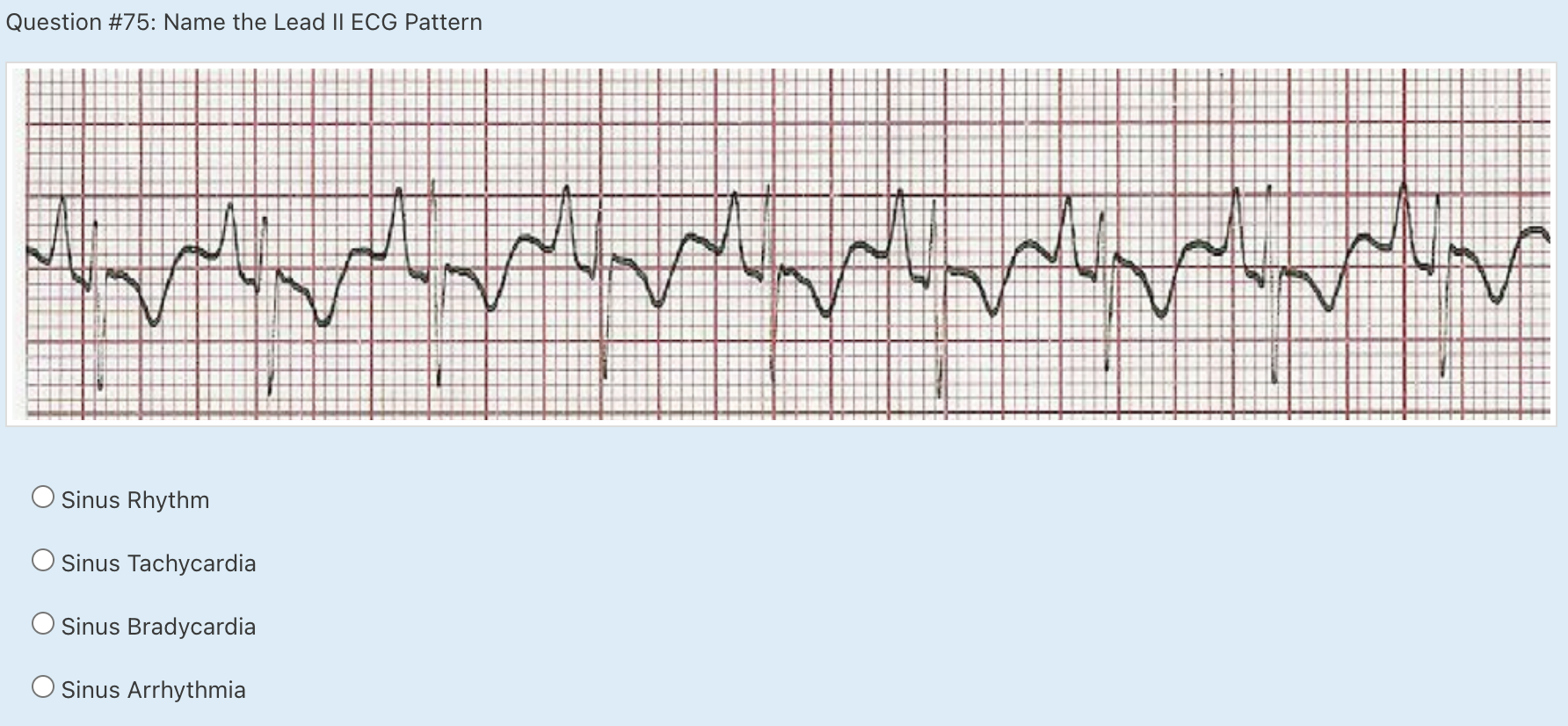 Solved Question #75: Name the Lead II ECG Pattern ཁརབ་ད ཆངར། | Chegg.com
