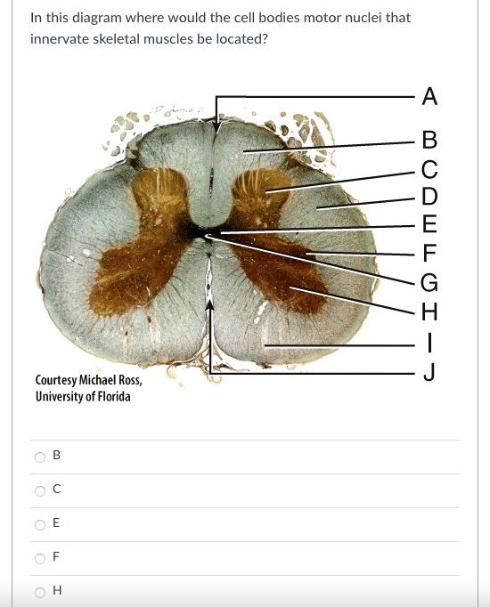 Solved In this diagram where would the cell bodies motor | Chegg.com