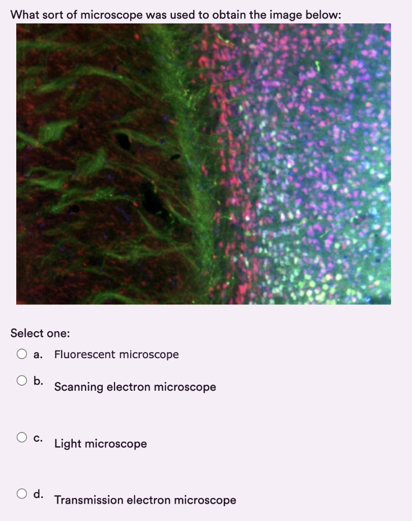 Solved What sort of microscope was used to obtain the image | Chegg.com