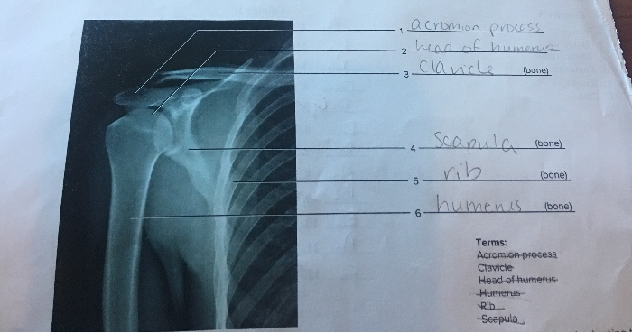 Lab 16 Pectoral Girdle And Upper Limb Flashcards Chegg 