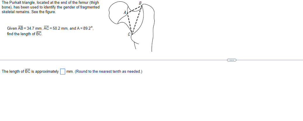 The Purkait triangle, located at the end of the femur (thigh
bone), has been used to identify the gender of fragmented skelet