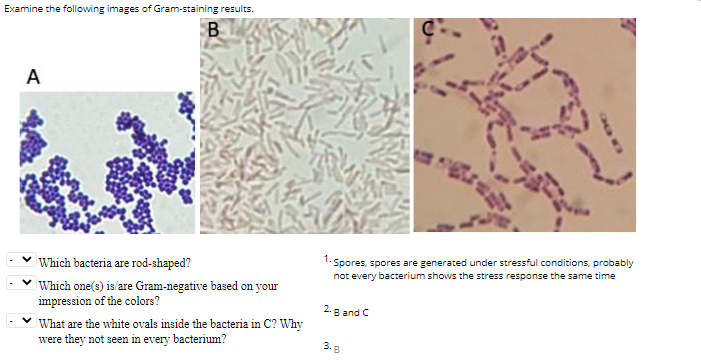 Solved Examine the following images of Gram-staining | Chegg.com