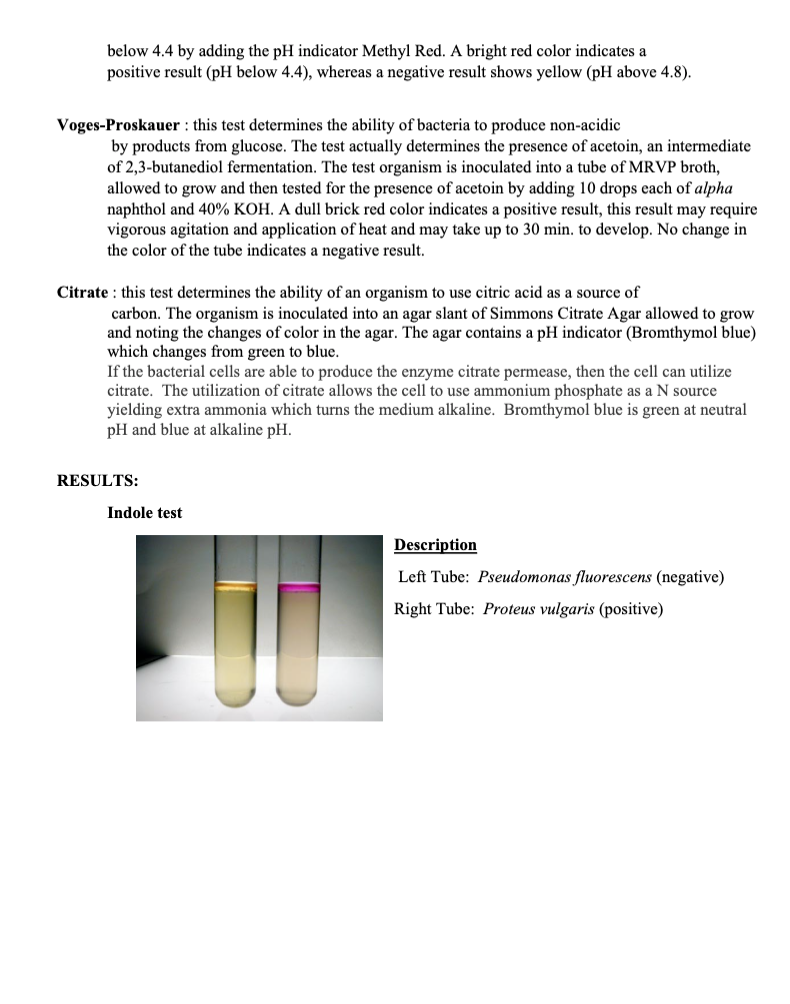 solved-lab-17-imvic-the-imvic-is-a-series-of-four-tests-chegg