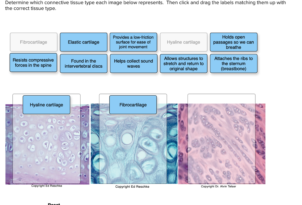 types of cartilage tissue