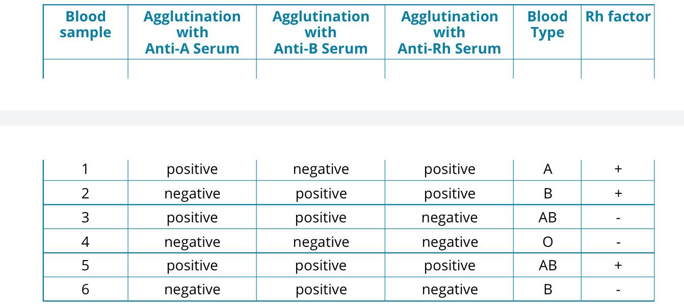 Solved Blood Sample Agglutination With Anti-A Serum | Chegg.com