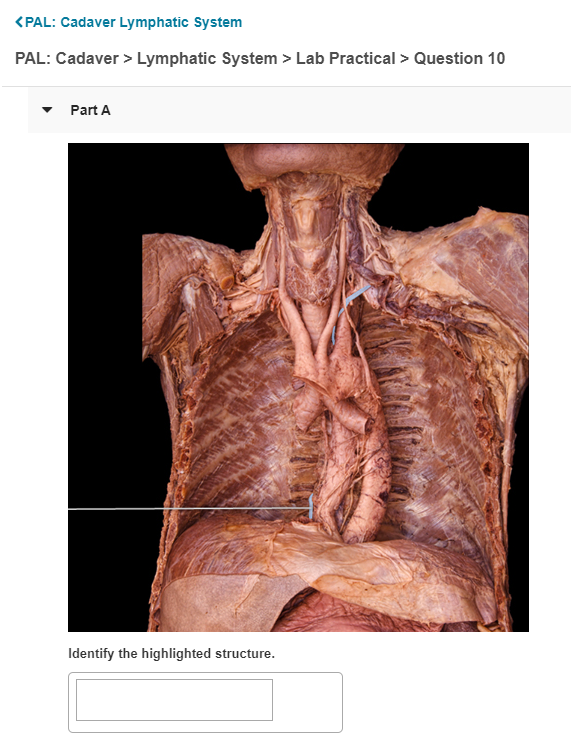 Pal Cadaver Lymphatic System Pal Cadaver Chegg 