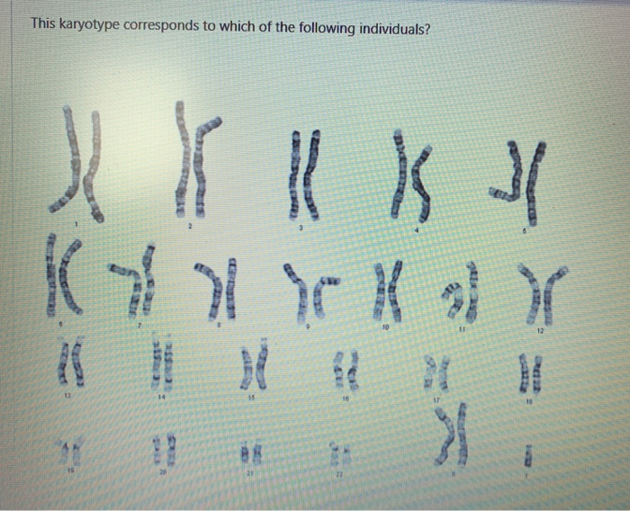 Solved If it were to be stretched out, the DNA in one of | Chegg.com