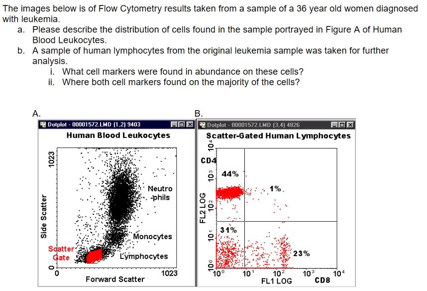 The images below is of Flow Cytometry results taken from a sample of a 36 year old women diagnosed with leukemia. a. Please d