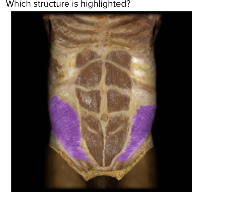 Which structure is highlighted? Multiple | Chegg.com