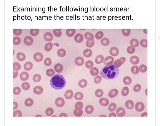 Solved How do you distinguish the different types of blood | Chegg.com