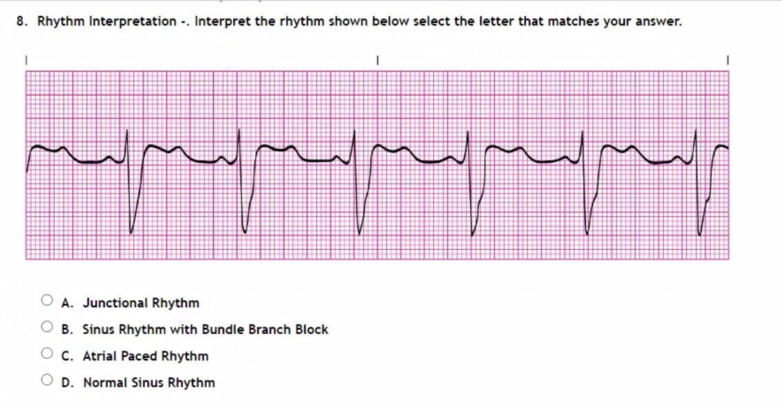 Solved 8. Rhythm Interpretation -. Interpret The Rhythm | Chegg.com