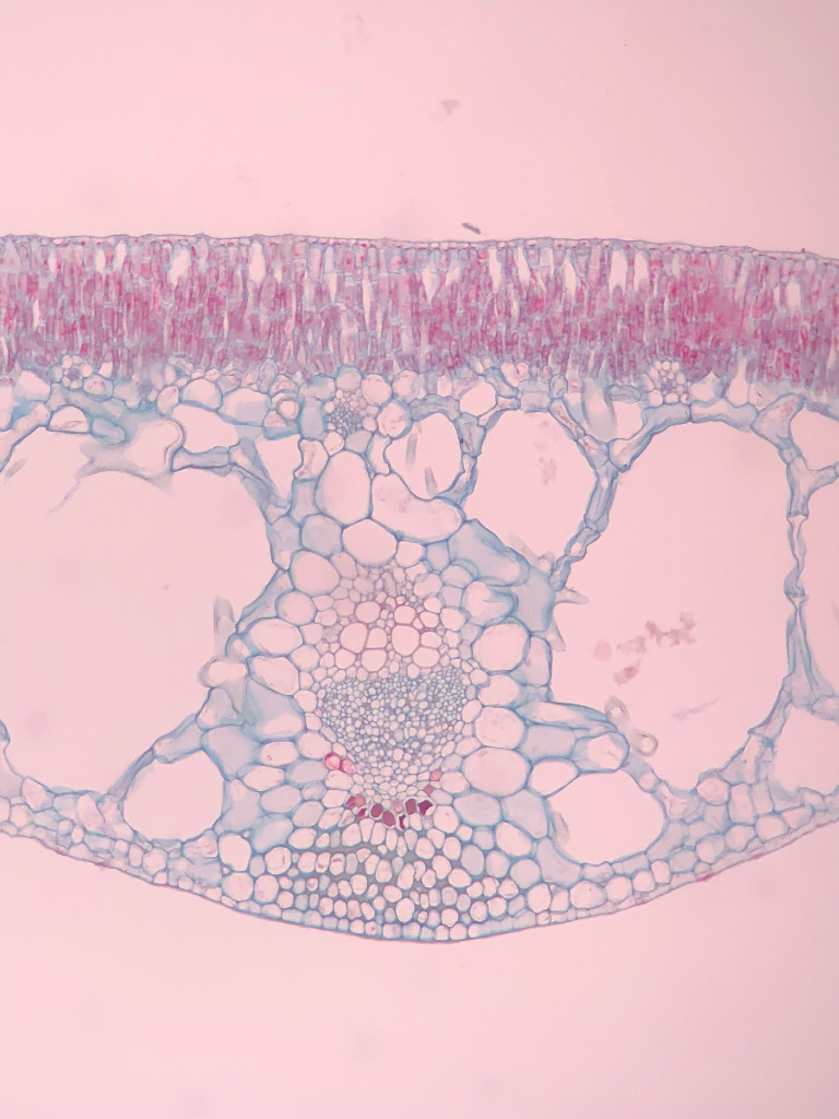 Solved Label and provide the definition for the Epidermis,