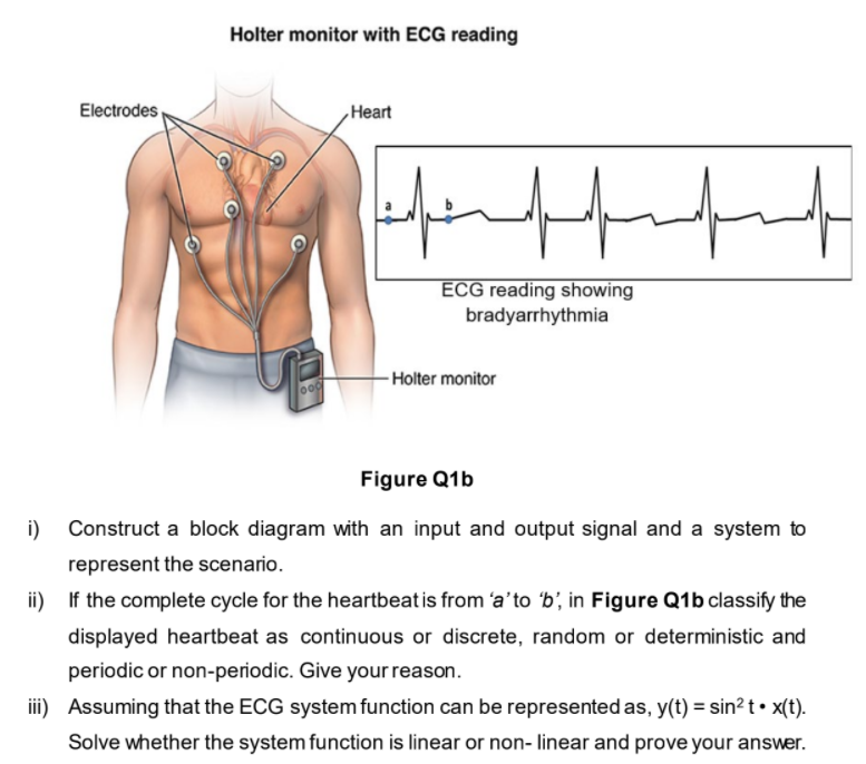 What To Expect From A Good Holter Monitor Reading