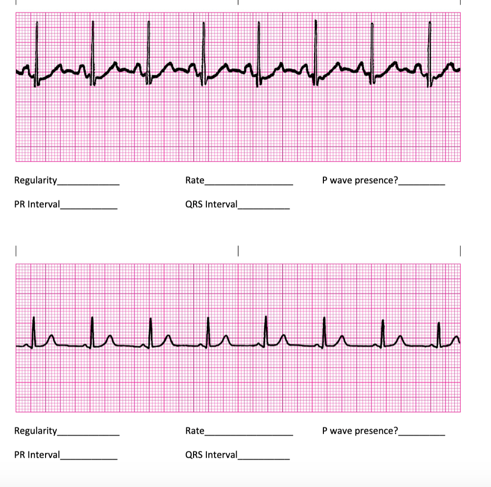 Solved Regularity_RateP wave presence?PR Interval.QRS | Chegg.com