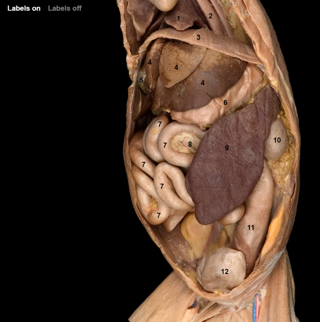 Solved: 1. Identify The Labeled Cat Blood Vessels, Structu ...