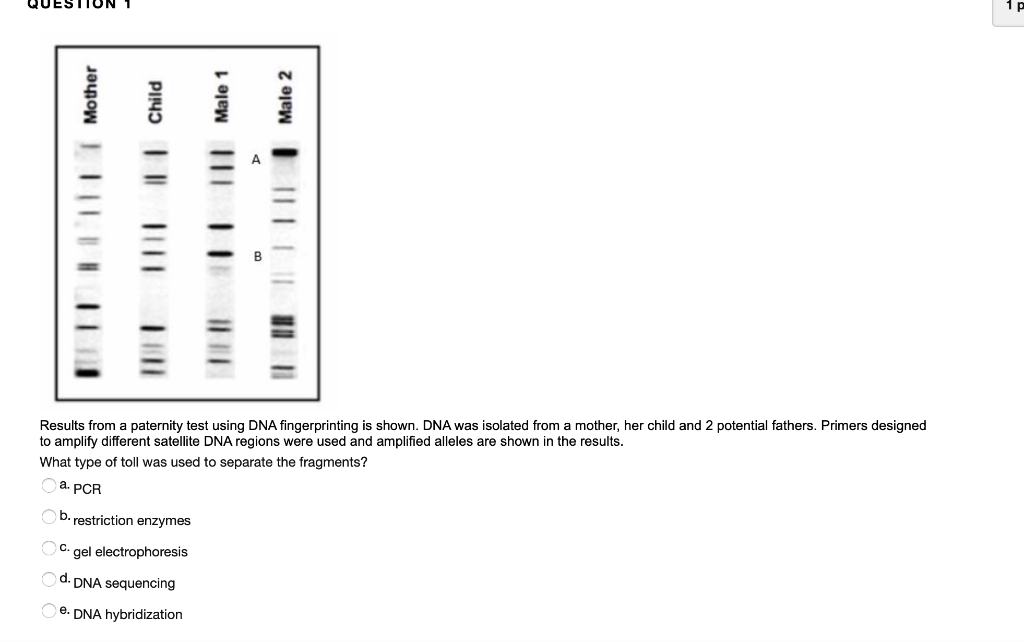 Solved Which item is not required for DNA sequencing? a. gel | Chegg.com