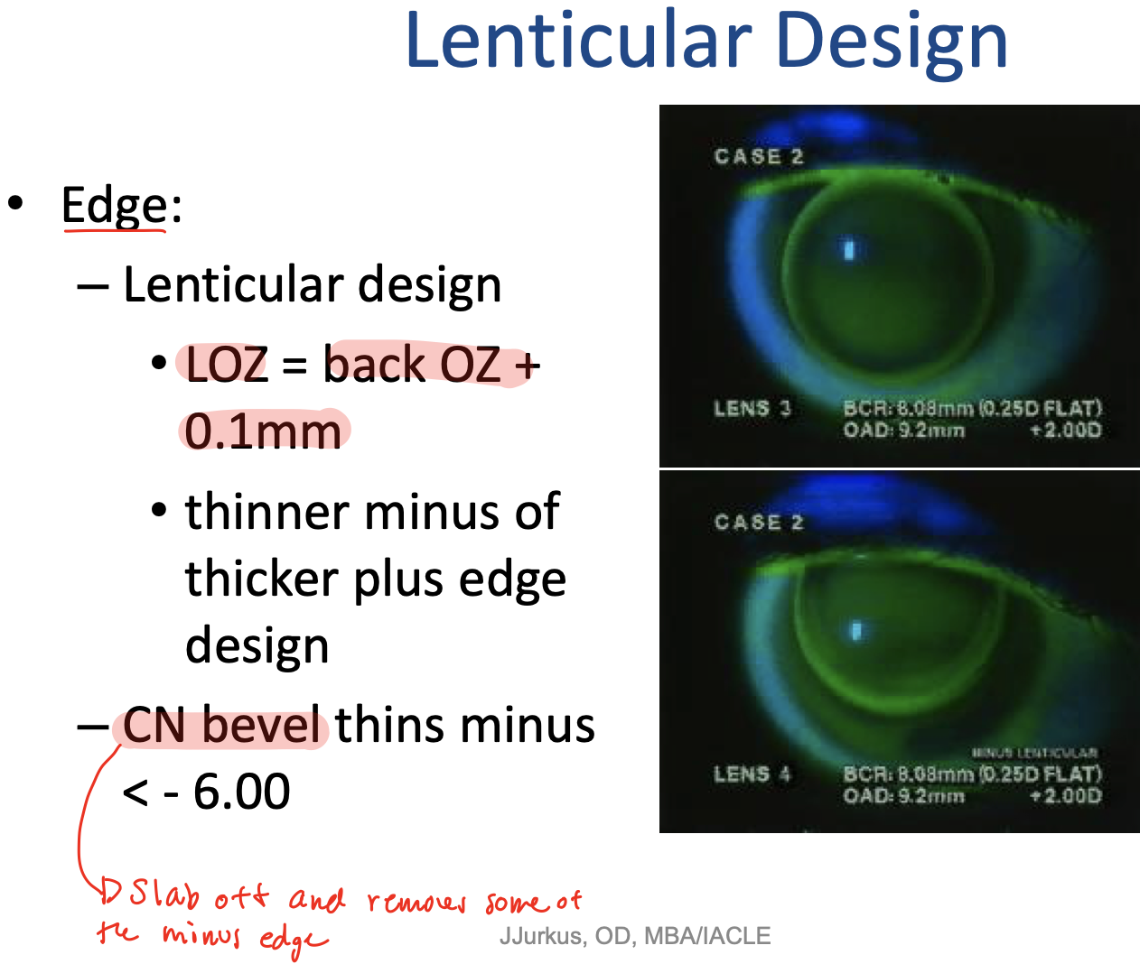 13 GP Fitting & Lens Evaluation Flashcards | Chegg.com