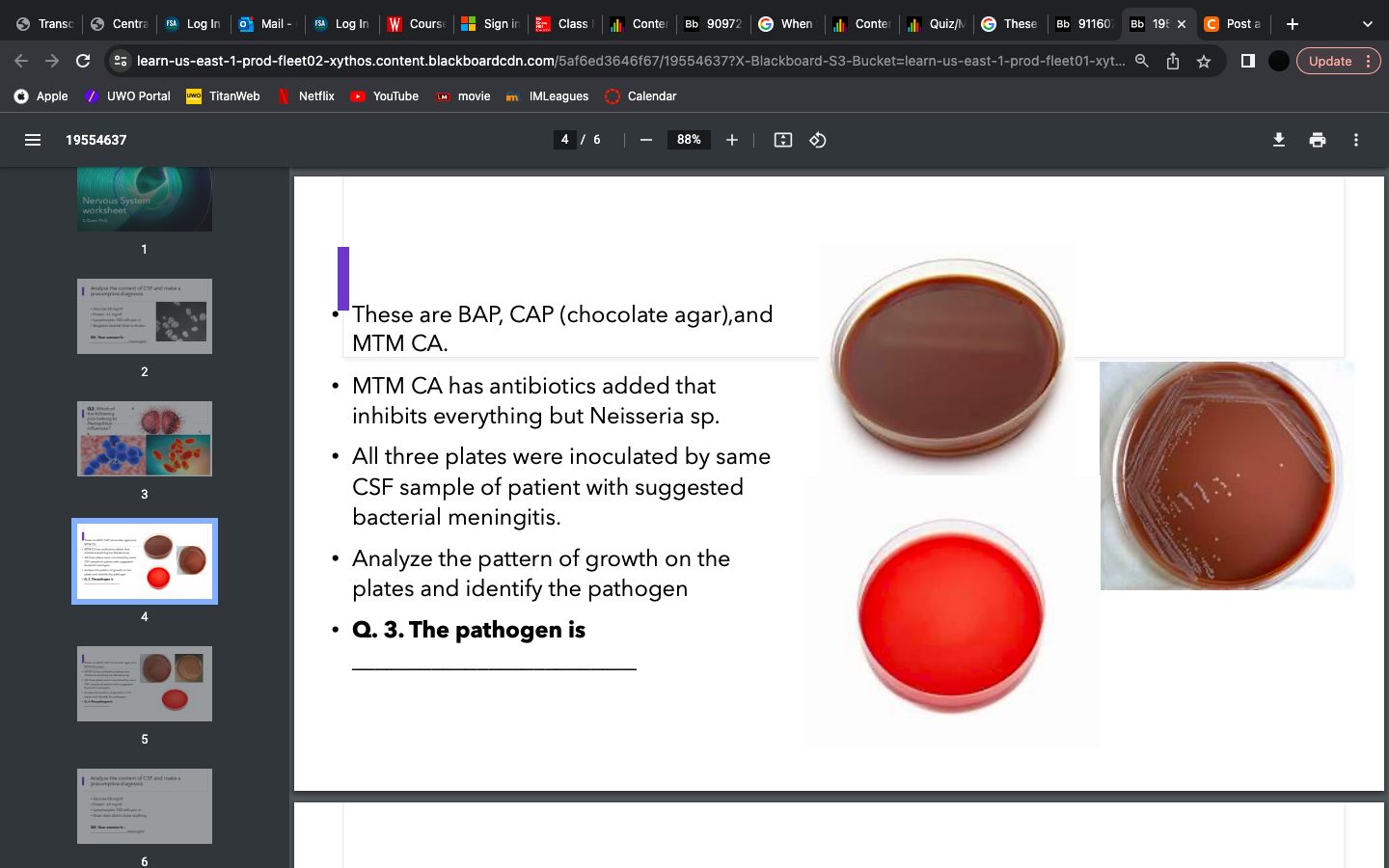 Solved These are BAP, CAP (chocolate agar), and MTM CA.