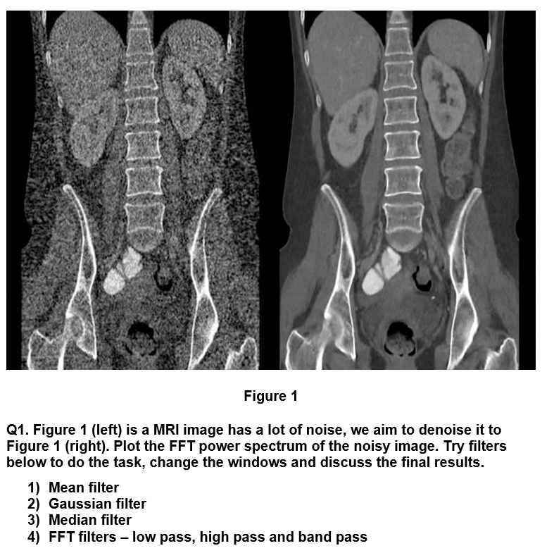 Narrow bandwidth - Questions and Answers ​in MRI