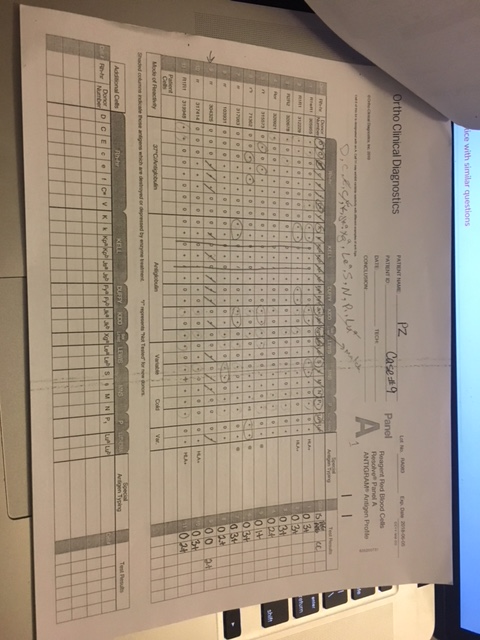 Resolution of Antibody Problems Answer the following | Chegg.com