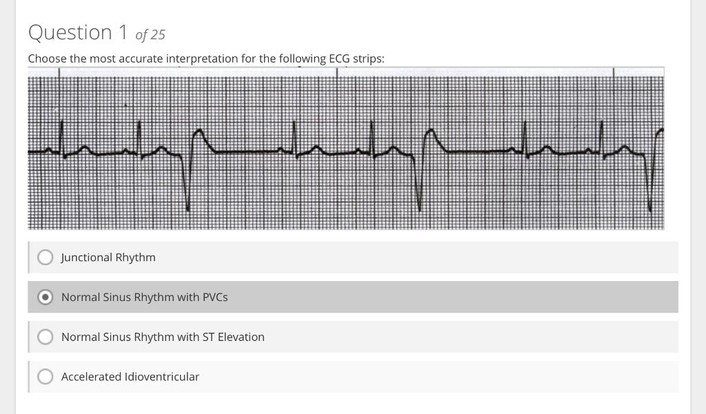 Junctional Rhythm
Normal Sinus Rhythm with PVCs
Normal Sinus Rhythm with ST Elevation
Accelerated Idioventricular