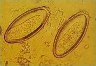 a platyhelminthes planaria tulajdonságai a papillomavírus rákot okoz