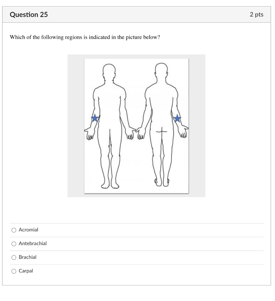 Solved Question 25 2 Pts Which Of The Following Regions Is | Chegg.com