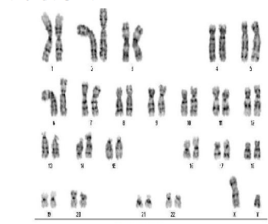 Solved Below is a selection of karyotypes showing | Chegg.com