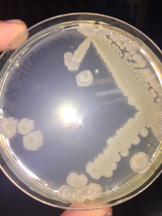 Solved So basically this is a TSA plate the first plate has | Chegg.com