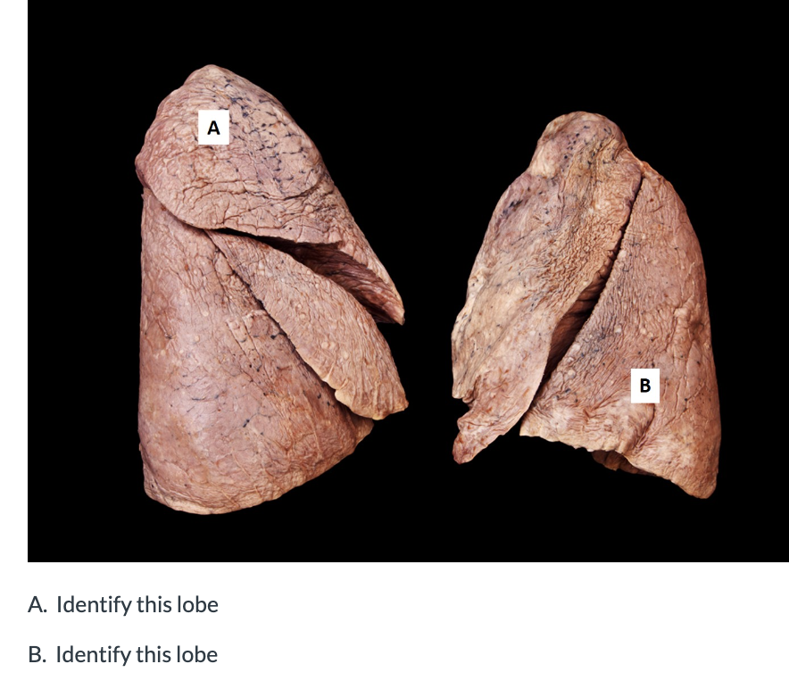 Solved A. Identify this lobe B. Identify this lobe | Chegg.com