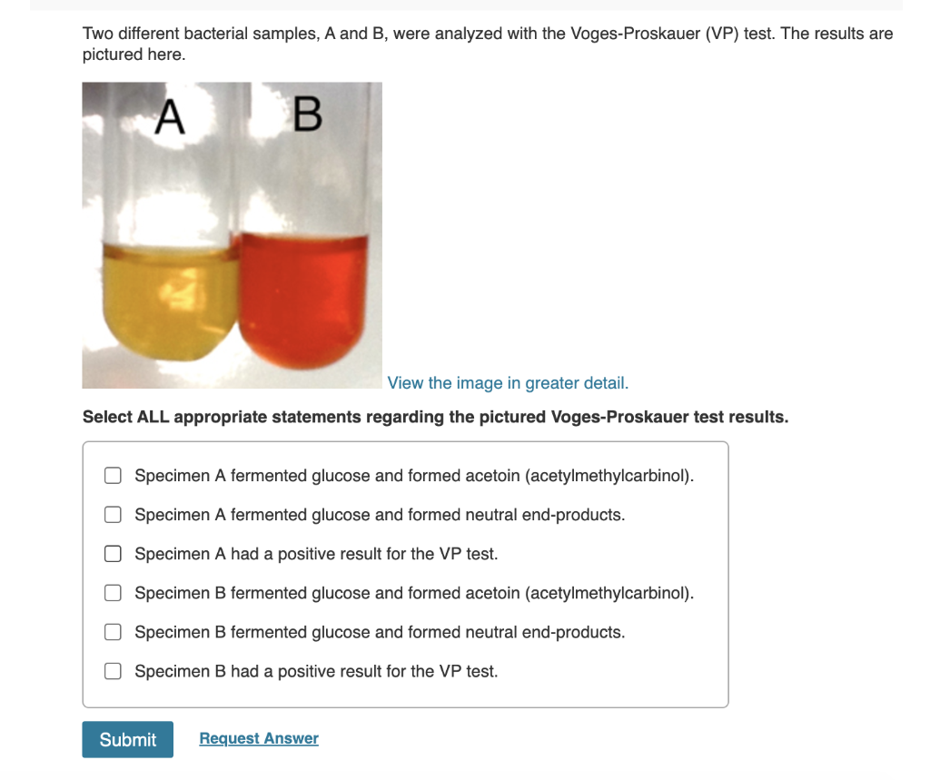 Solved Two Different Bacterial Samples A And B Were Ana Chegg Com