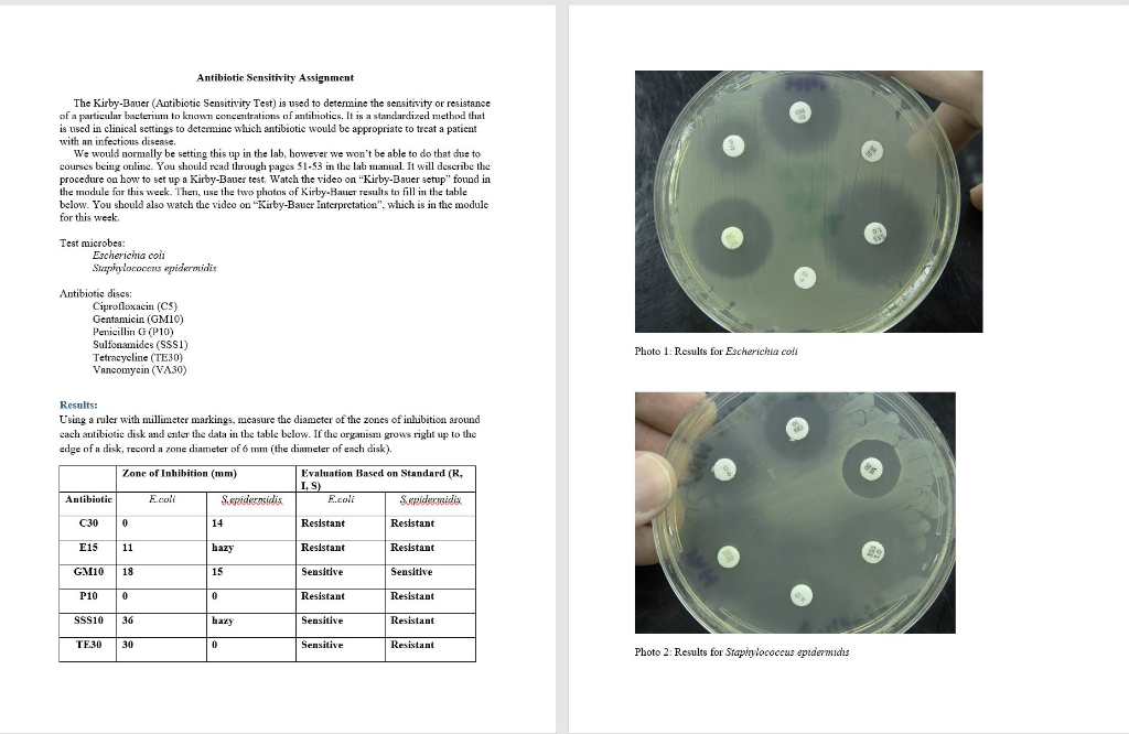 Solved Antibiotic Sensitivity Assignment The KirbyBauer