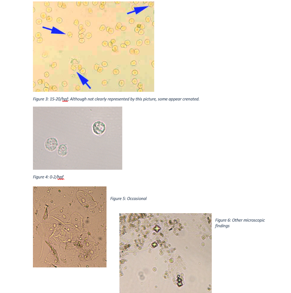 3.4.5 urinalysis case study 6