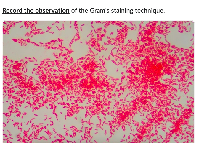 Solved Identify the biochemical test to differentiate Gram's | Chegg.com