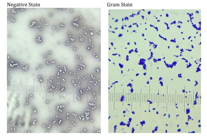 staphylococcus epidermidis negative stain